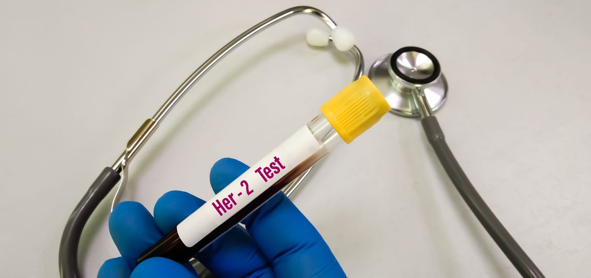 Medicinrådet anbefaler IKKE brug af nyt lægemiddel til behandling af metastaserende HER2+ brystkræft