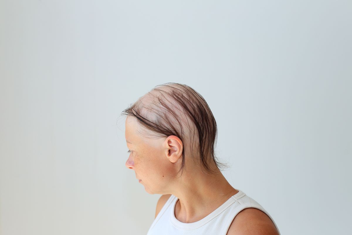 Kølehætter kommer 'ind i varmen' i Kræftplan V