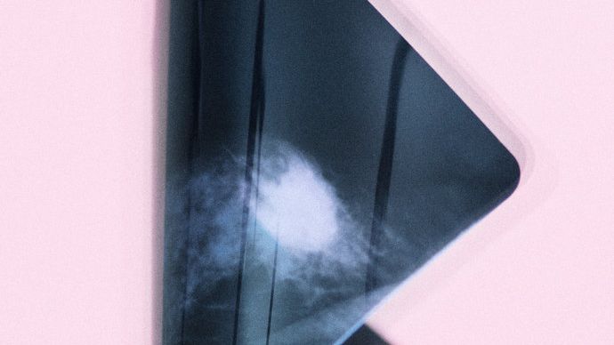 De oversete senfølger efter kræft