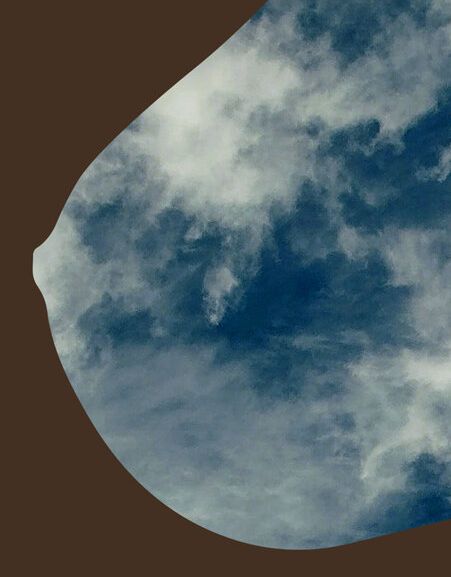 Tæt brystvæv er en risikofaktor